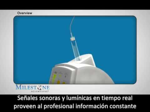 Sistema The Wand STA de Inibsa Dental - dirigido a profesionales sanitarios