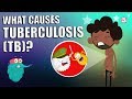 TUBERCULOSIS | What Is Tuberculosis | TB - Tuberculosis Disease | The Dr Binocs Show | Peekaboo Kidz