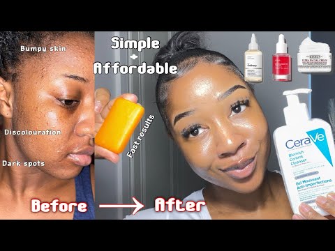 HOW TO GET CLEAR & SMOOTH SKIN | Simple Step by step routine to brighten dark marks + discolouration