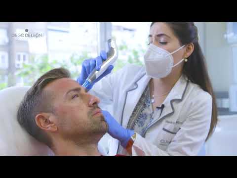 El Efecto GLOWY de RAFA MORA – Dermapen