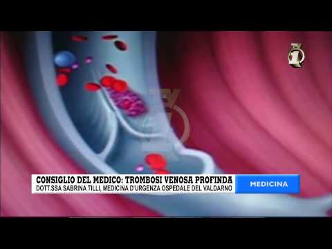 Rimedi popolari per lartrite e lartrosi della spalla congiunta Che cosa è lartrosi del ginocchio, senza il