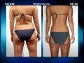 Ab Circle Pro As Seen On Tv Commercial