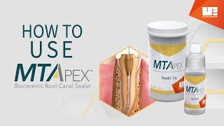 How to Use MTApex™ bioceramic root canal sealer | Step-by-Step