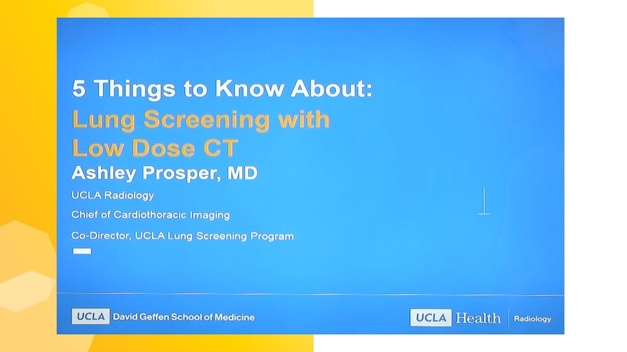 Lung Screening with Low Dose CT | UCLA Radiology
