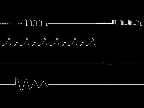 Attack of the PETSCII Robots - Metal Heads (Commodore 64) [MSX-MUSIC Cover]