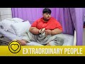 World S Heaviest Boy Weighs 31 Stone