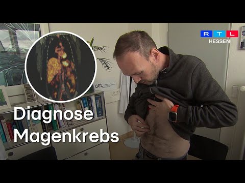 Der vom Krebs befallene Magen wurde Stefan Friedchen aus Eppstein entfernt