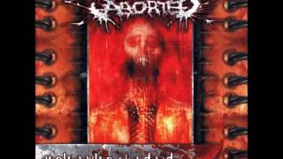 Aborted- Engineering The Dead