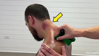 Neck *GUNK* 😳 Massive NECK Injury Causes Tech Neck 😭 Effective Cracks & Stretching Help! - Dr. Ed