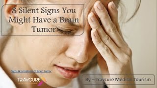 8 Silent Signs You Might Have a Brain Tumor
