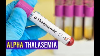 Alpha thalassemia - Clear Explain