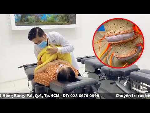 Điều trị TRƯỢT ĐỐT SỐNG bằng phương pháp KHÔNG DÙNG THUỐC