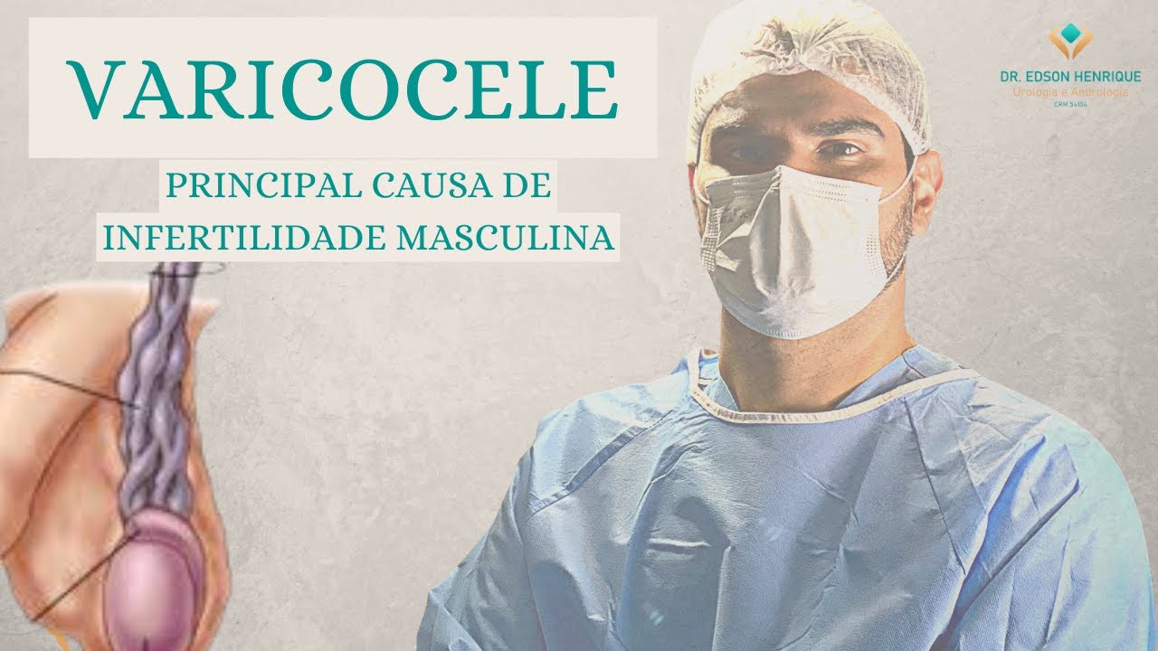 Edson  Nascimento-12