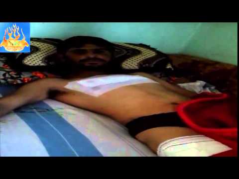 إصابة أحد عناصر لواء خط النار أثنار قطع الإمداد على حاجز الحاكورة في ريف حماة