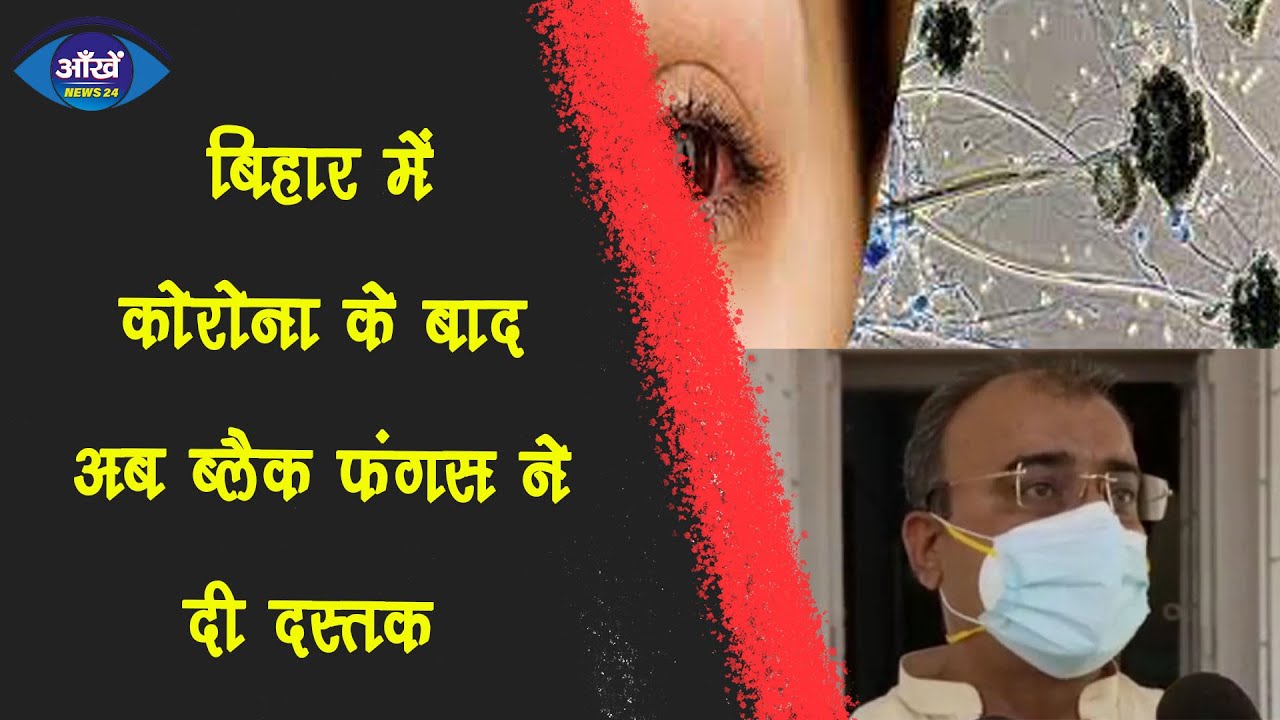 स्वास्थ्य मंत्री मंगल पांडेय- बिहार में कोरोना के बीच ब्लैक फंगस ने भी दस्तक दे दी है ।