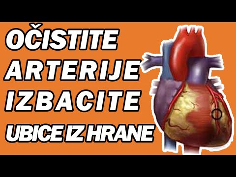 NAJJAČE UBICE HOLESTEROLA - KLJUČ ZA ZDRAVO SRCE! Dr Mihajlović