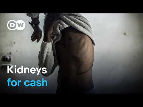 The global organ trafficking network | DW Documentary