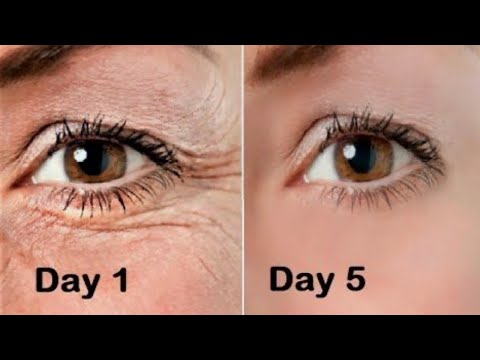 Wonderful Botox Mask That Drove The World Crazy 🤩