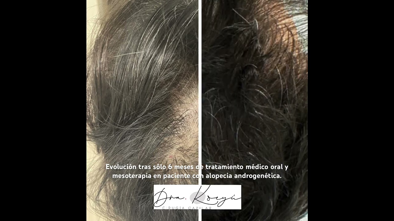 Carmen Orozco Bello-6