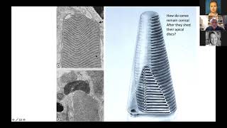 Photoreceptor/Retinal Pigment Epithelium Interactions in Health and Disease by Dean Bok, PhD | UCI