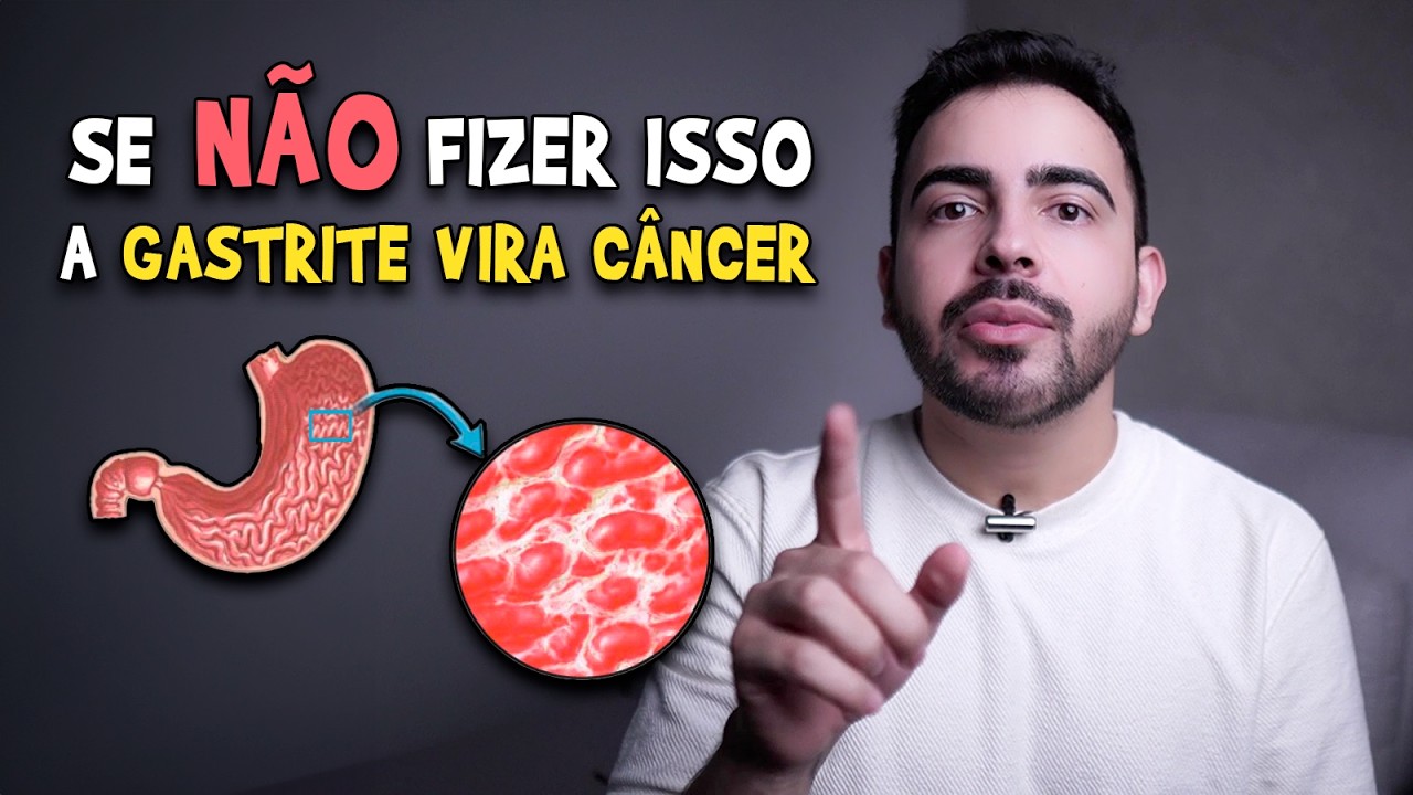 Toda GASTRITE vira CÂNCER!? │ Médico Explica