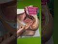 Some Vaginas Need Extra Support Pelvicfloorhealth Prolapse