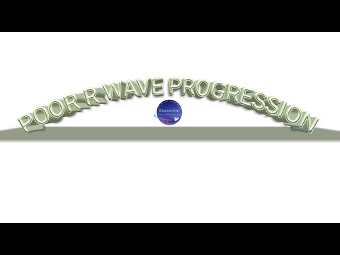 5  Normal R wave Progression USMLE, FCPS, NLE, PLAB, AMC, CLE