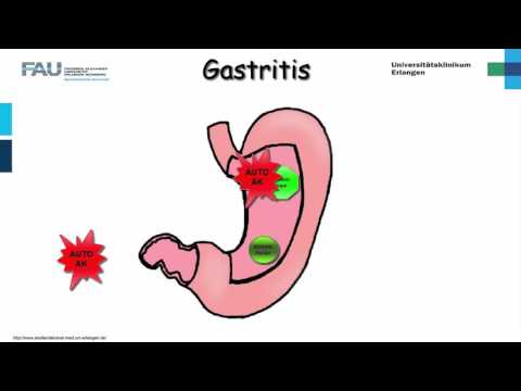 Hypertonischen Lösung, dass dies der Preis Wasser-Salz-Form hypertensive Krisen
