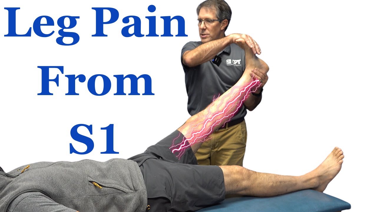 Leg Pain from S1 Nerve Root Compression (Most COMMON Signs and Symptoms)