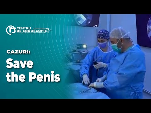 De ce s  a mărit penisul