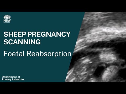 Sheep Pregnancy Scanning: Foetal reabsorption