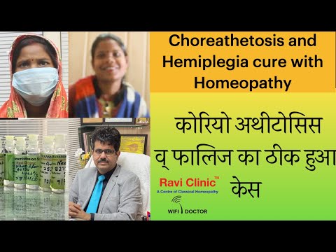 Choreoathetosis and Hemiplegia Case Treated by Homeopathy Dr Ravi Singh