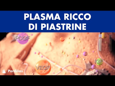 Plasma ricco di piastrine ©