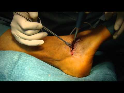 Wie Osteochondrose der Brustwirbelsäule während der Schwangerschaft zu behandeln Zu denen für die Behandlung von Hüfte der Arzt fragen