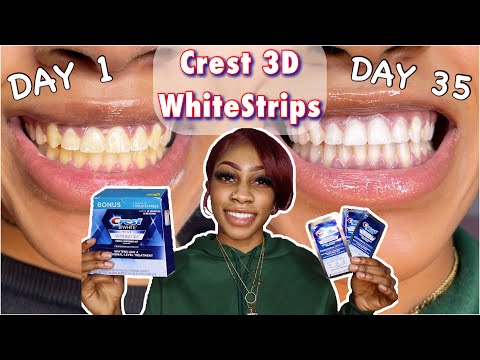 I TRIED CREST 3D WHITESTRIPS For 30 DAYS | CHEAP Teeth Whitening Hack | Before & After Results😱
