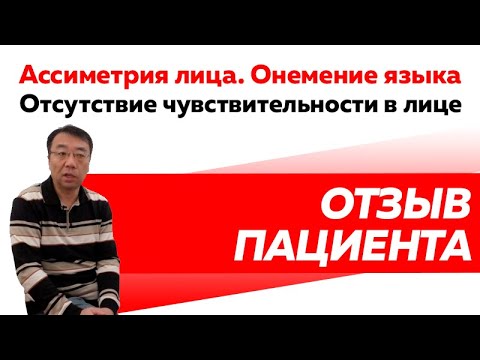 Отзыв Rekinetix. Нейропатия лицевого нерва слева.