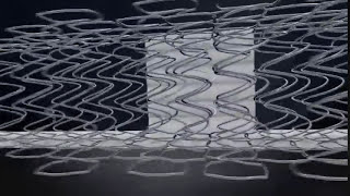 Sealy Posturepedic | Advanced Coil Technology Explained