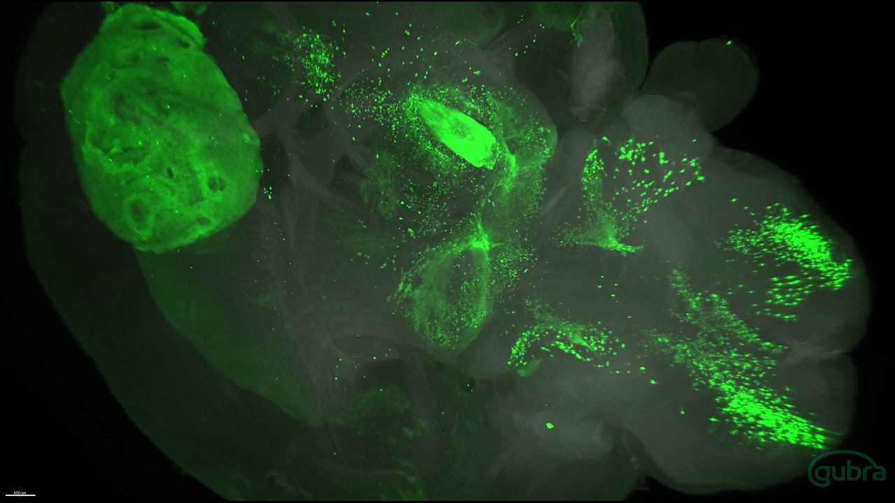 Whole mouse brain with single cell resolution