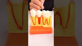 How To Floss Under A Bridge