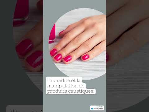 Vidéo : fissures et crevasses des doigts — causes et traitement