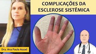 Complicações da esclerose sistêmica no coração, pulmões, rins, intestinos e outros locais do corpo