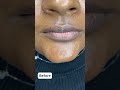 5 sessions healed dark lip neutralization result #permanentmakeup #pmu #darklipcorrection