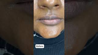 5 sessions healed dark lip neutralization result #permanentmakeup #pmu #darklipcorrection