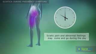 Sciatica during pregnancy Symptoms
