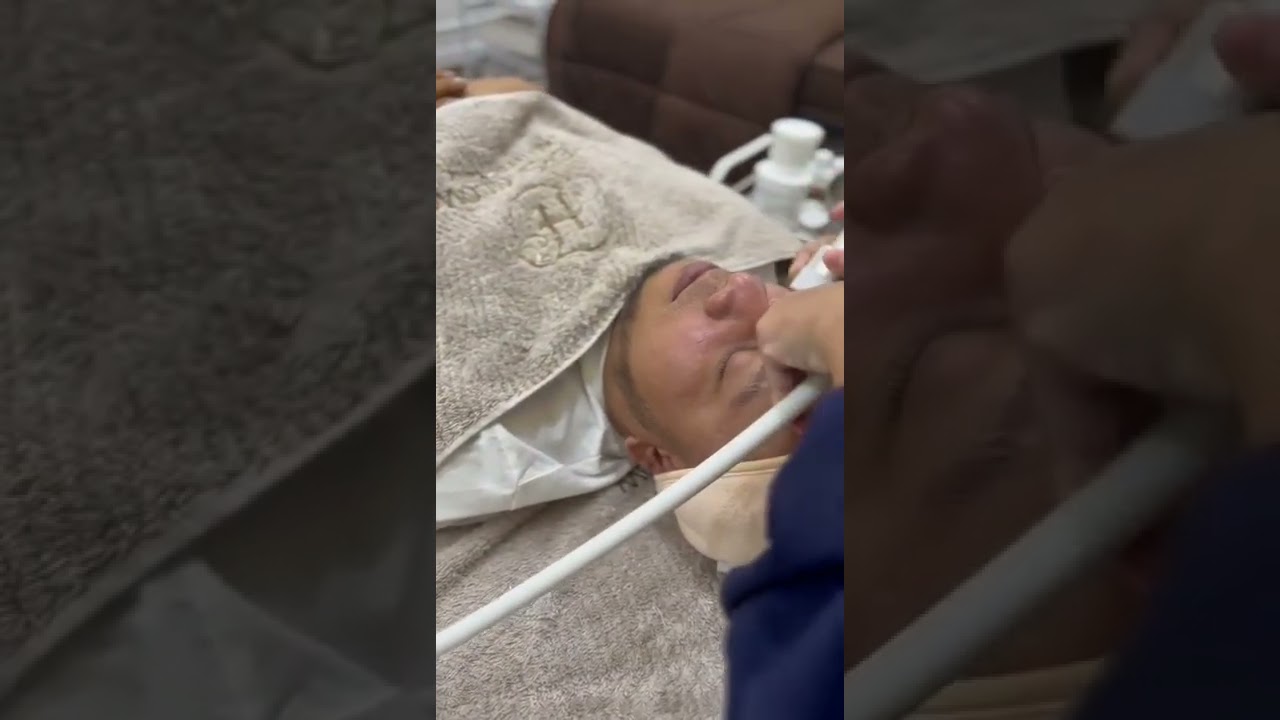 Micro Athena USA Treatment #shorts #perawatan #glowingskin #hersaglow