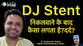 DJ Stent Removal — Complete Walkthrough