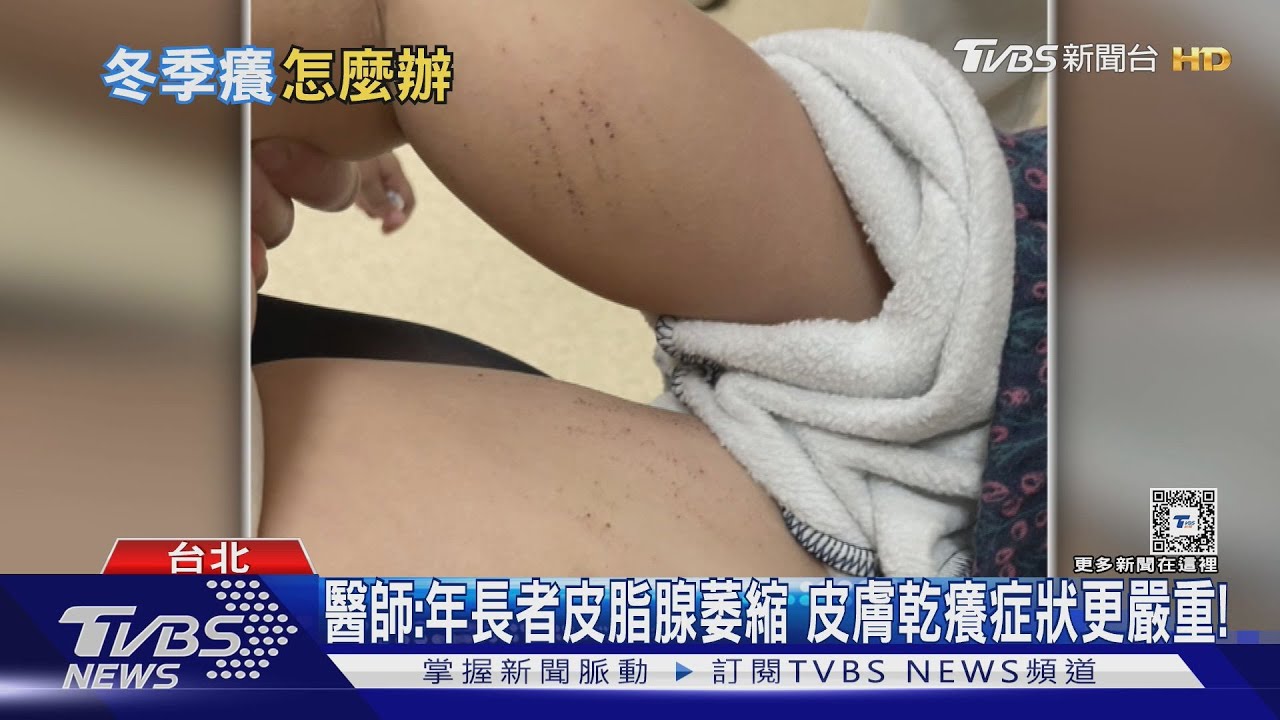 皮膚脫皮、龜裂、乾燥 醫警告:千萬別做「這件事」 後果難以想像