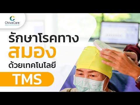 รีวิวประสบการณ์การรักษาซึมเศร้าด้วย TMS