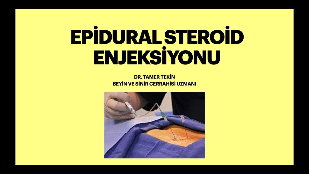 Epidural Steroid Enjeksiyonu