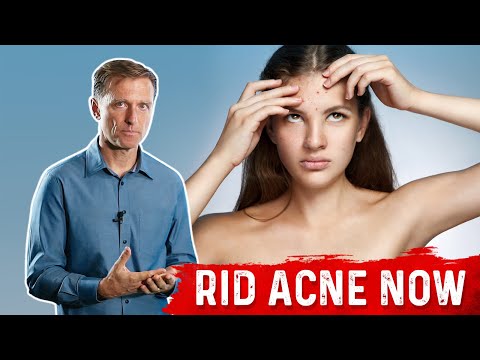 Why PROTEIN Does Not Help Hair Loss Brittle Nails and Collagen Loss – Dr Berg